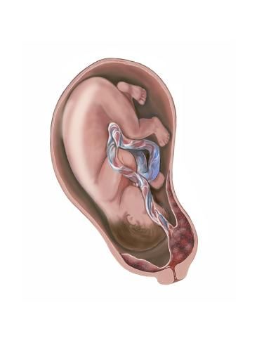 Is Anterior Placenta a Problem in Early Pregnancy?
