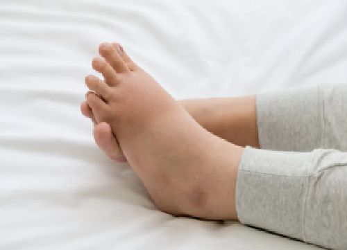 Why Your Feet Hurt During Pregnancy