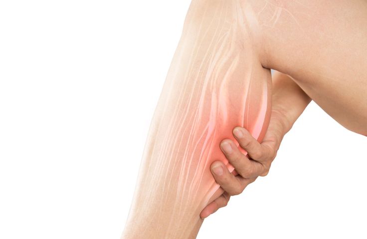 Why Your Legs Are Screaming at 3 AM — And What Actually Helps Pregnancy Leg Cramps