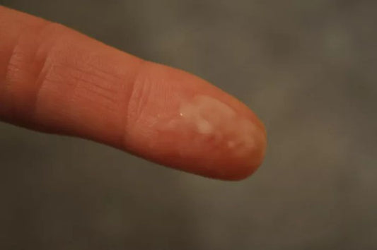 Mucus Plug 101: The Questions Every Mom-to-Be Asks