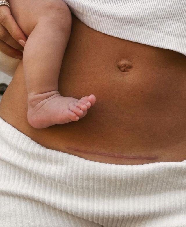 Is My Baby Actually Moving Enough? What Anterior Placenta Mamas Need to Know at 21 Weeks