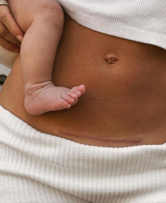 Is My Baby Actually Moving Enough? What Anterior Placenta Mamas Need to Know at 21 Weeks